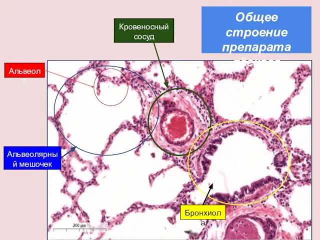 Альвеолярный мешочек Альвеола Бронхиола Кровеносный сосуд Общее строение препарата лёгкого