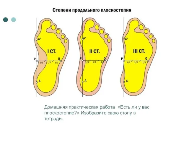 Домашняя практическая работа «Есть ли у вас плоскостопие?» Изобразите свою стопу в тетради.