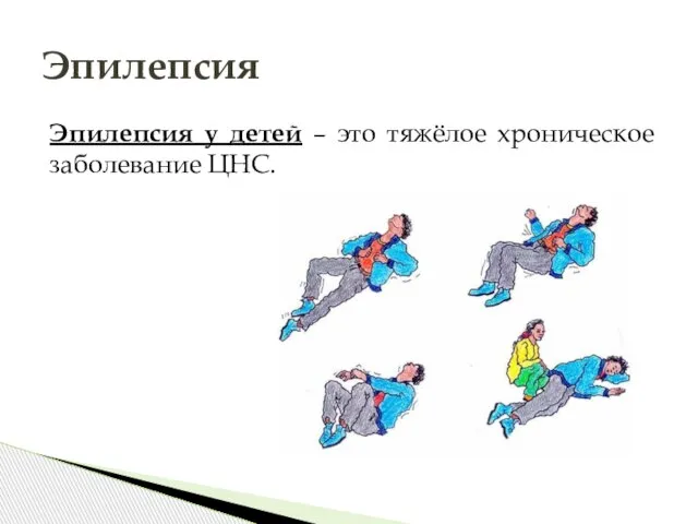 Эпилепсия у детей – это тяжёлое хроническое заболевание ЦНС. Эпилепсия