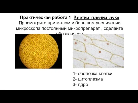 Практическая работа 1 Клетки пленки лука Просмотрите при малом и большом увеличении