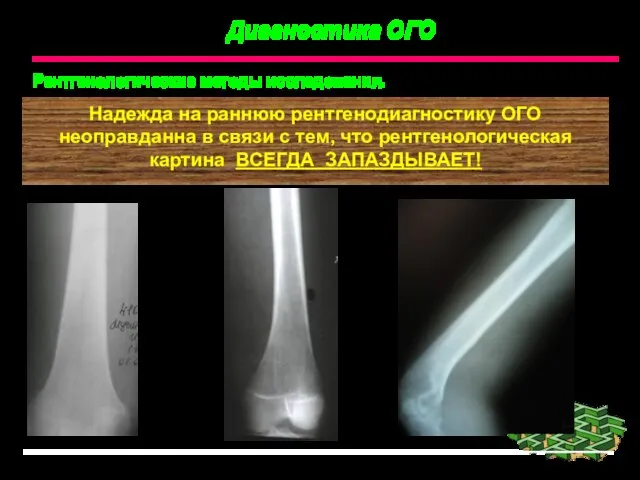 Диагностика ОГО Рентгенологические методы исследования. Надежда на раннюю рентгенодиагностику ОГО неоправданна в