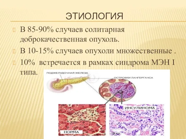 ЭТИОЛОГИЯ В 85-90% случаев солитарная доброкачественная опухоль. В 10-15% случаев опухоли множественные