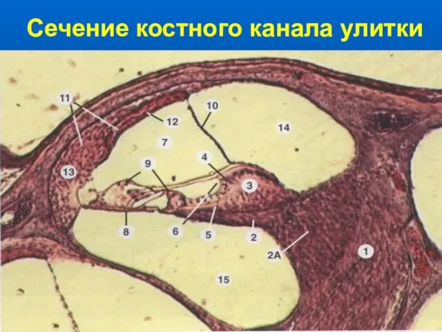 Сечение костного канала улитки