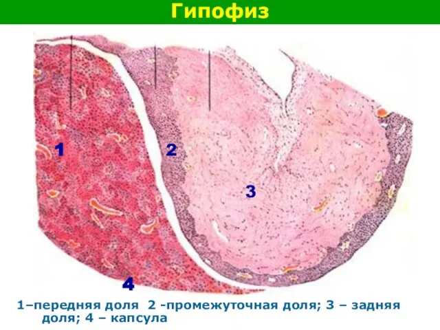 Гипофиз 1–передняя доля 2 -промежуточная доля; 3 – задняя доля; 4 –