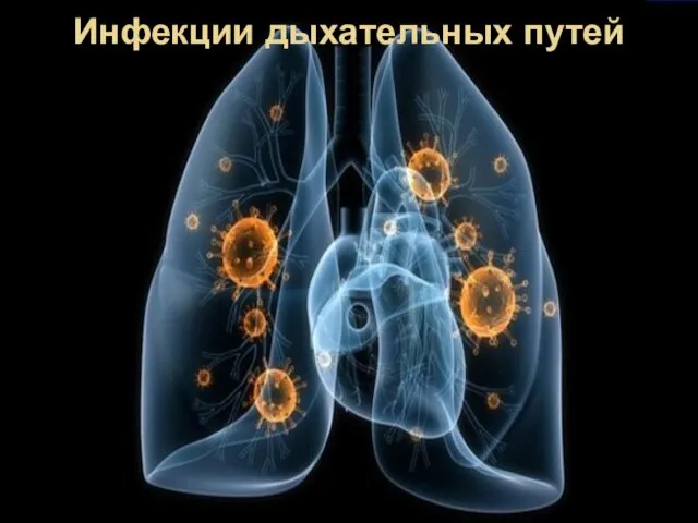 Инфекции дыхательных путей