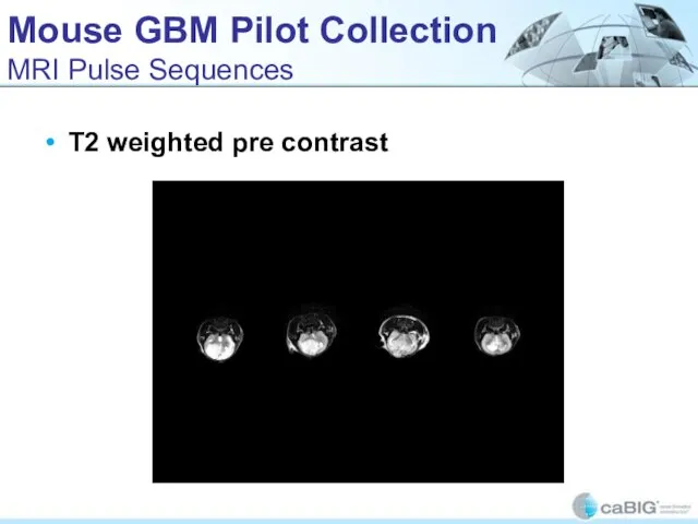 Mouse GBM Pilot Collection MRI Pulse Sequences T2 weighted pre contrast