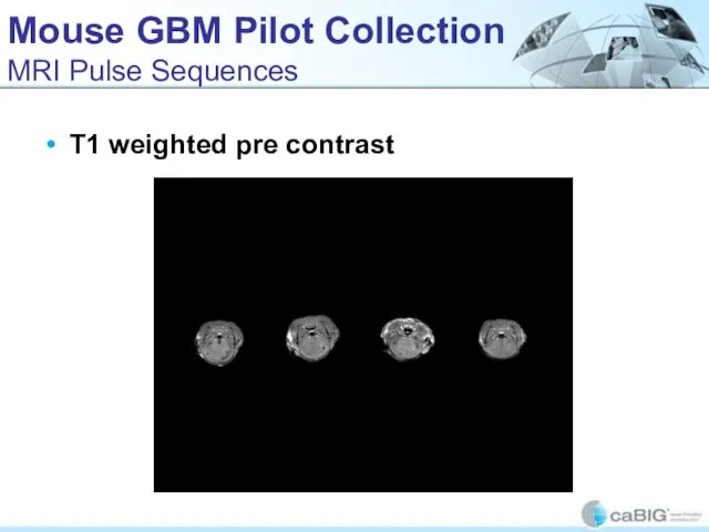 Mouse GBM Pilot Collection MRI Pulse Sequences T1 weighted pre contrast