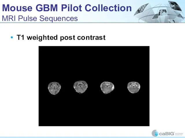 Mouse GBM Pilot Collection MRI Pulse Sequences T1 weighted post contrast
