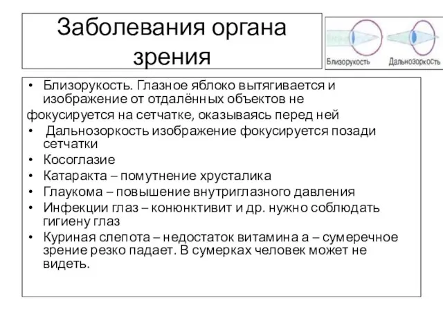 Заболевания органа зрения Близорукость. Глазное яблоко вытягивается и изображение от отдалённых объектов