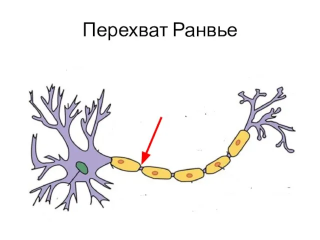 Перехват Ранвье