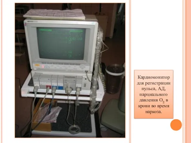 Кардиомонитор для регистрации пульса, АД, парциального давления О2 в крови во время наркоза.