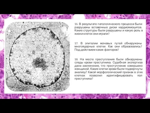 16. В результате патологического процесса были разрушены вставочные диски кардиомиоцитов. Какие структуры