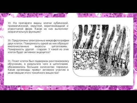 19. На препарате видны клетки кубической, призматической, округлой, веретеновидной и отростчатой форм.