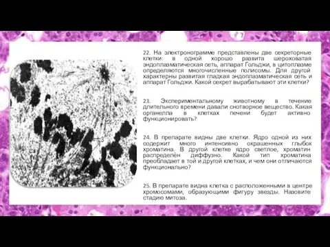 22. На электронограмме представлены две секреторные клетки: в одной хорошо развита шероховатая