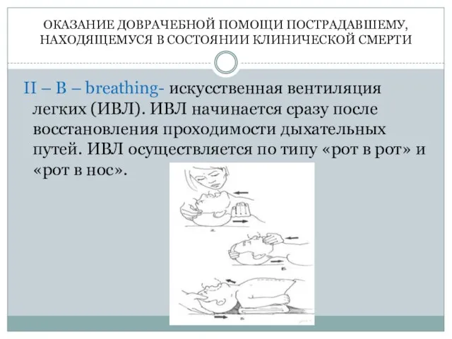 ОКАЗАНИЕ ДОВРАЧЕБНОЙ ПОМОЩИ ПОСТРАДАВШЕМУ, НАХОДЯЩЕМУСЯ В СОСТОЯНИИ КЛИНИЧЕСКОЙ СМЕРТИ II – B