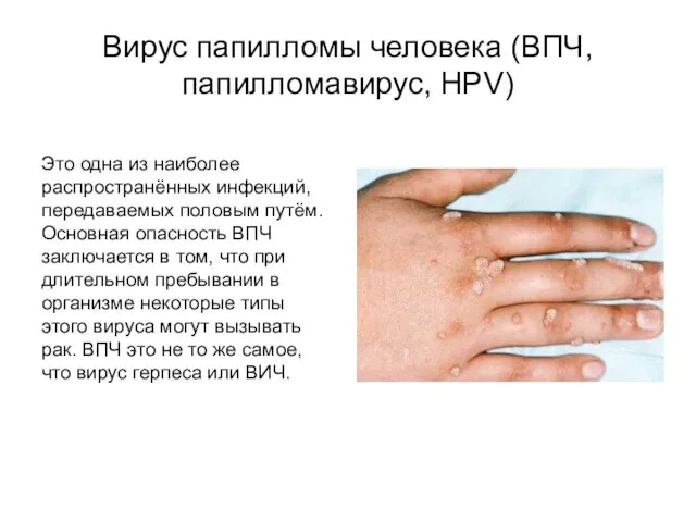 Вирус папилломы человека (ВПЧ, папилломавирус, HPV) Это одна из наиболее распространённых инфекций,