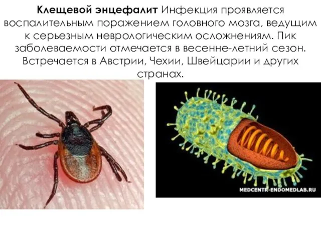 Клещевой энцефалит Инфекция проявляется воспалительным поражением головного мозга, ведущим к серьезным неврологическим