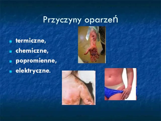 Przyczyny oparzeń termiczne, chemiczne, popromienne, elektryczne.