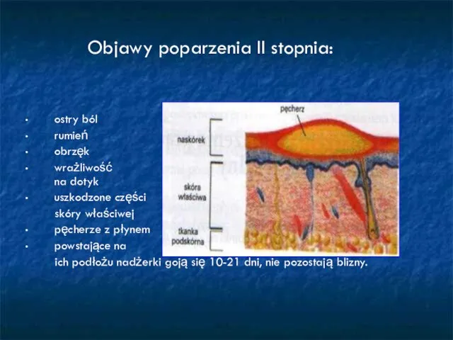 Objawy poparzenia II stopnia: ostry ból rumień obrzęk wrażliwość na dotyk uszkodzone