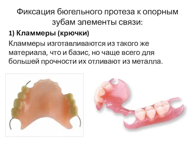 Фиксация бюгельного протеза к опорным зубам элементы связи: 1) Кламмеры (крючки) Кламмеры