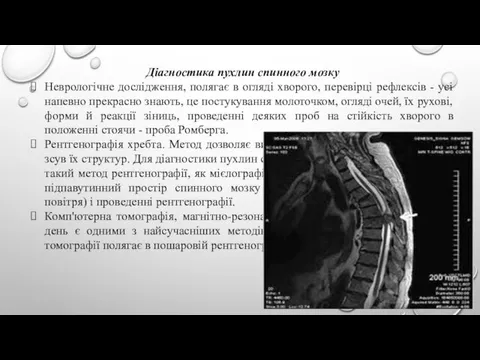 Діагностика пухлин спинного мозку Неврологічне дослідження, полягає в огляді хворого, перевірці рефлексів