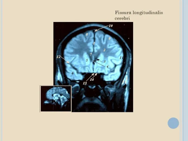 Fissura longitudinalis cerebri