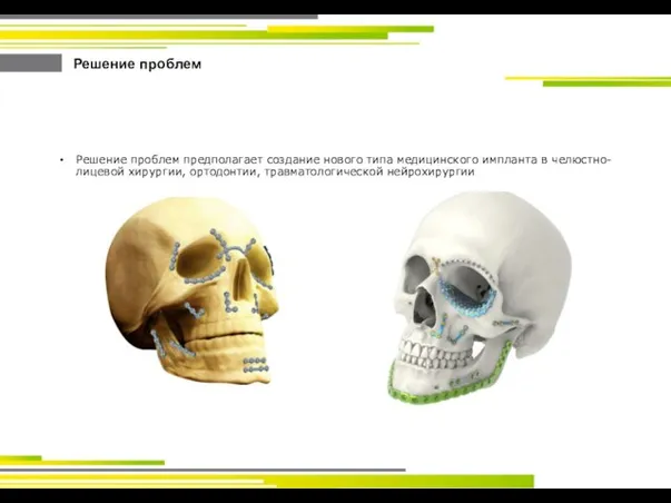Решение проблем Решение проблем предполагает создание нового типа медицинского импланта в челюстно-лицевой хирургии, ортодонтии, травматологической нейрохирургии