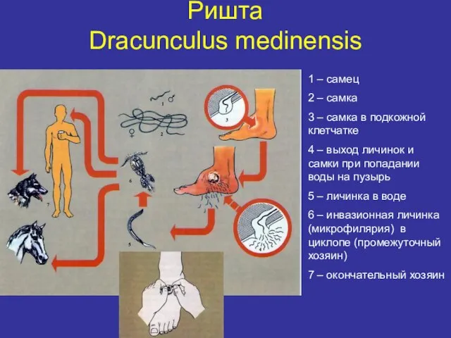Ришта Dracunculus medinensis 1 – самец 2 – самка 3 – самка