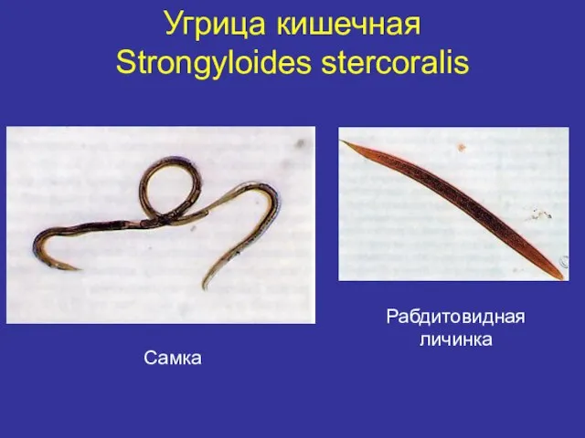Угрица кишечная Strongyloides stercoralis Самка Рабдитовидная личинка