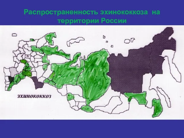 Распространенность эхинококкоза на территории России