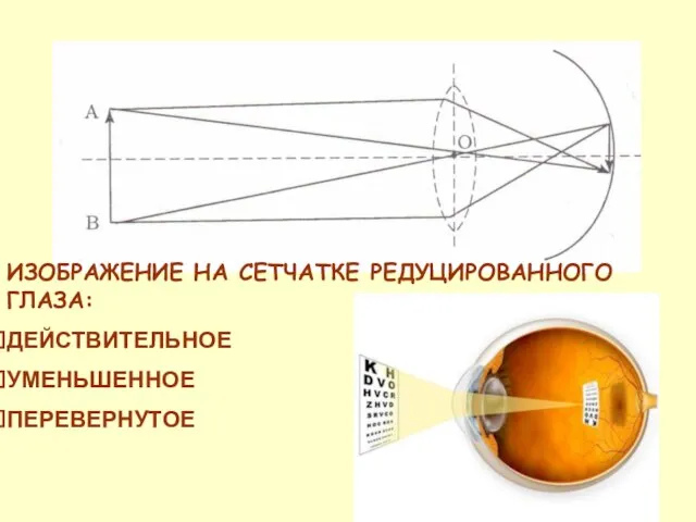 ИЗОБРАЖЕНИЕ НА СЕТЧАТКЕ РЕДУЦИРОВАННОГО ГЛАЗА: ДЕЙСТВИТЕЛЬНОЕ УМЕНЬШЕННОЕ ПЕРЕВЕРНУТОЕ