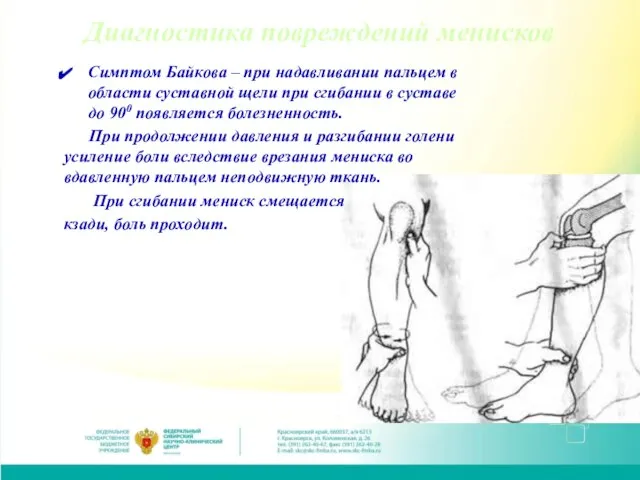 Симптом Байкова – при надавливании пальцем в области суставной щели при сгибании