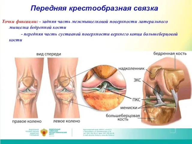 Передняя крестообразная связка Точки фиксации: - задняя часть межмыщелковой поверхности латерального мыщелка