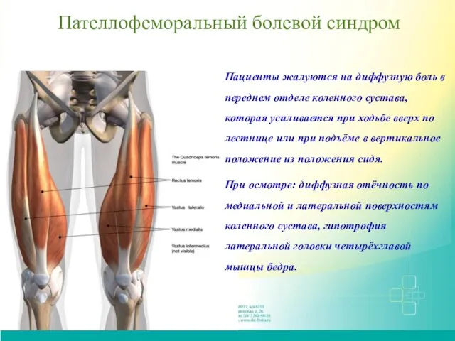 Пателлофеморальный болевой синдром Пациенты жалуются на диффузную боль в переднем отделе коленного