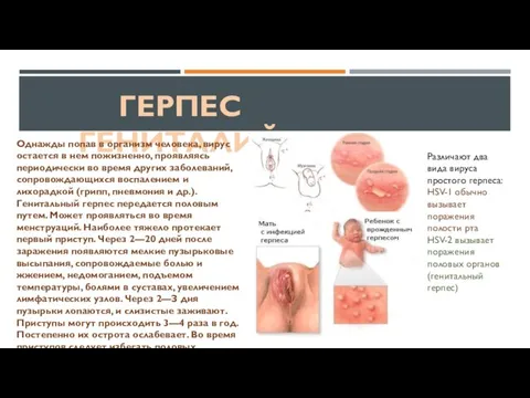 ГЕРПЕС ГЕНИТАЛИЙ Однажды попав в организм человека, вирус остается в нем пожизненно,