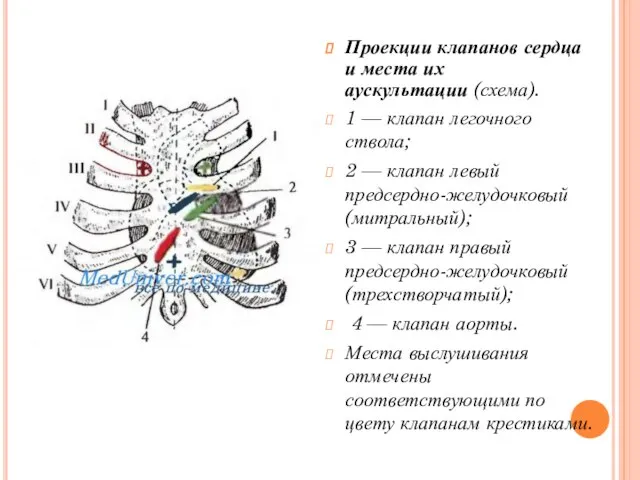 Проекции клапанов сердца и места их аускультации (схема). 1 — клапан легочного