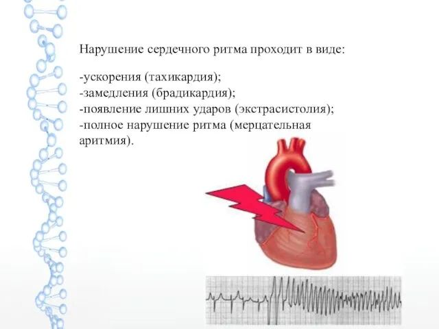 Нарушение сердечного ритма проходит в виде: -ускорения (тахикардия); -замедления (брадикардия); -появление лишних