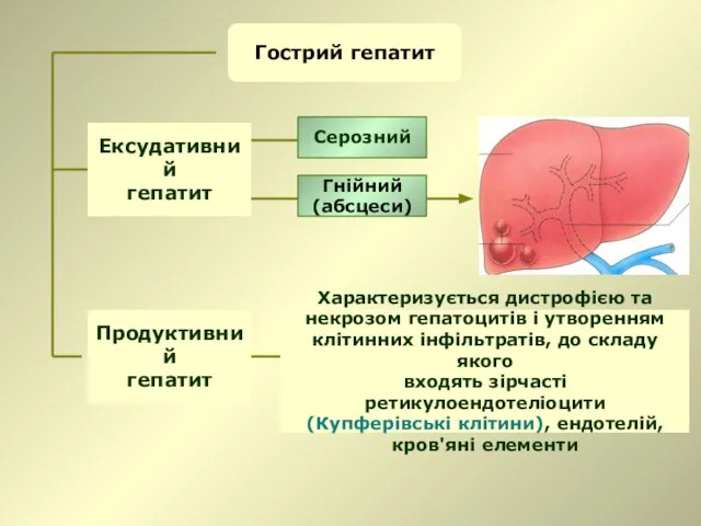 Гострий гепатит Ексудативний гепатит Серозний Гнійний (абсцеси) Продуктивний гепатит Характеризується дистрофією та