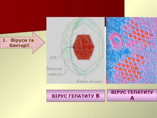 Етіологія ВІРУС ГЕПАТИТУ В ВІРУС ГЕПАТИТУ А Віруси та бактерії