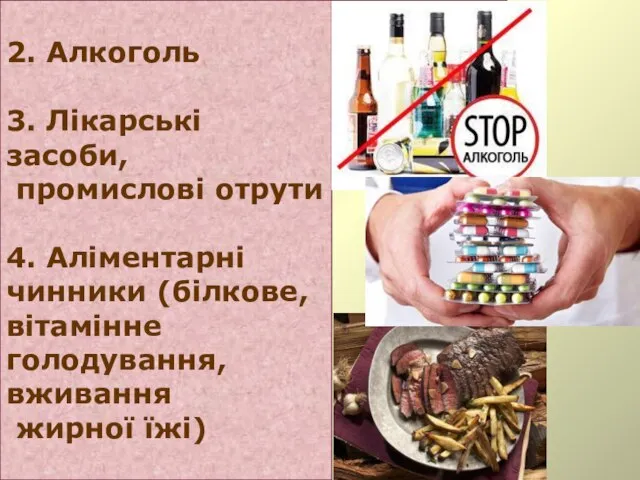 2. Алкоголь 3. Лікарські засоби, промислові отрути 4. Аліментарні чинники (білкове, вітамінне голодування, вживання жирної їжі)