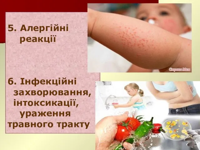 5. Алергійні реакції 6. Інфекційні захворювання, інтоксикації, ураження травного тракту