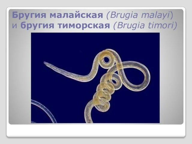 Бругия малайская (Brugia malayi) и бругия тиморская (Brugia timori)