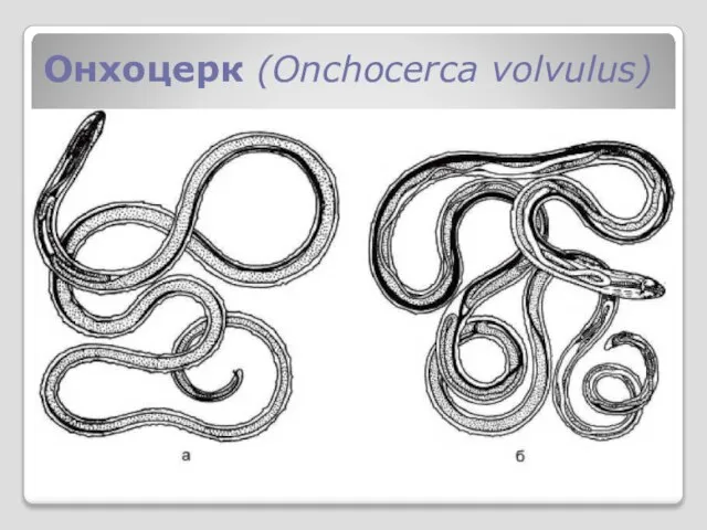 Онхоцерк (Onchocerca volvulus)