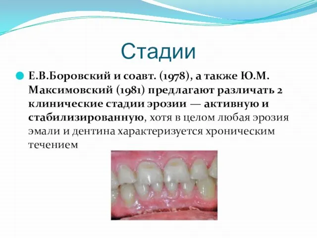 Стадии Е.В.Боровский и соавт. (1978), а также Ю.М.Максимовский (1981) предлагают различать 2