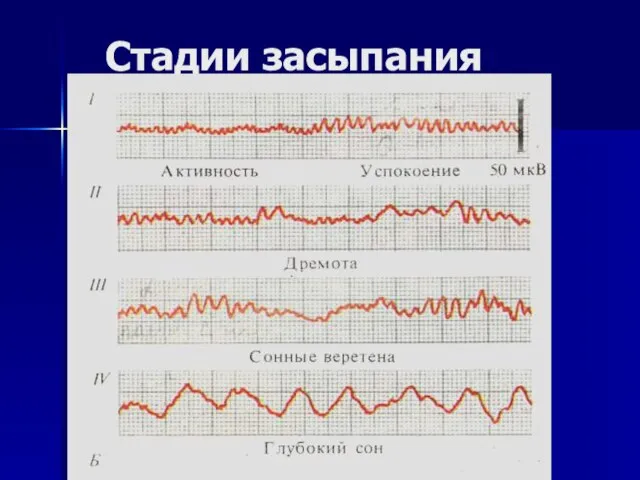 Стадии засыпания