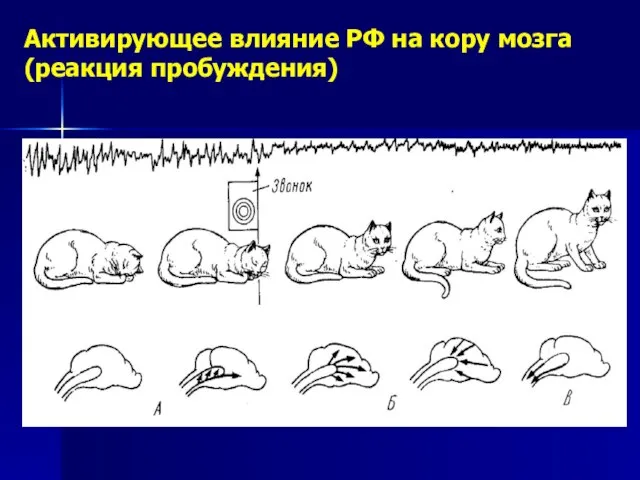 Активирующее влияние РФ на кору мозга (реакция пробуждения)