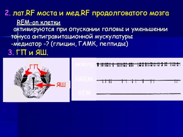 2. лат.RF моста и мед.RF продолговатого мозга REM-on клетки -активируются при опускании