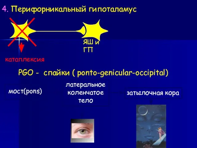 PGO - спайки ( ponto-genicular-occipital) латеральное коленчатое тело затылочная кора 4. Перифорникальный гипоталамус катаплексия