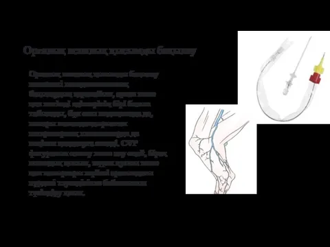 Орталық веналық қысымды бақылау Орталық веналық қысымды бақылау инвазивті гемодинамикалық бақылаудың қарапайым,