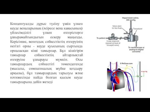 Концептуалды дұрыс түсіну үшін үлкен кеуде веналарының (әсіресе вена кавасының) үйлесімділігі үлкен